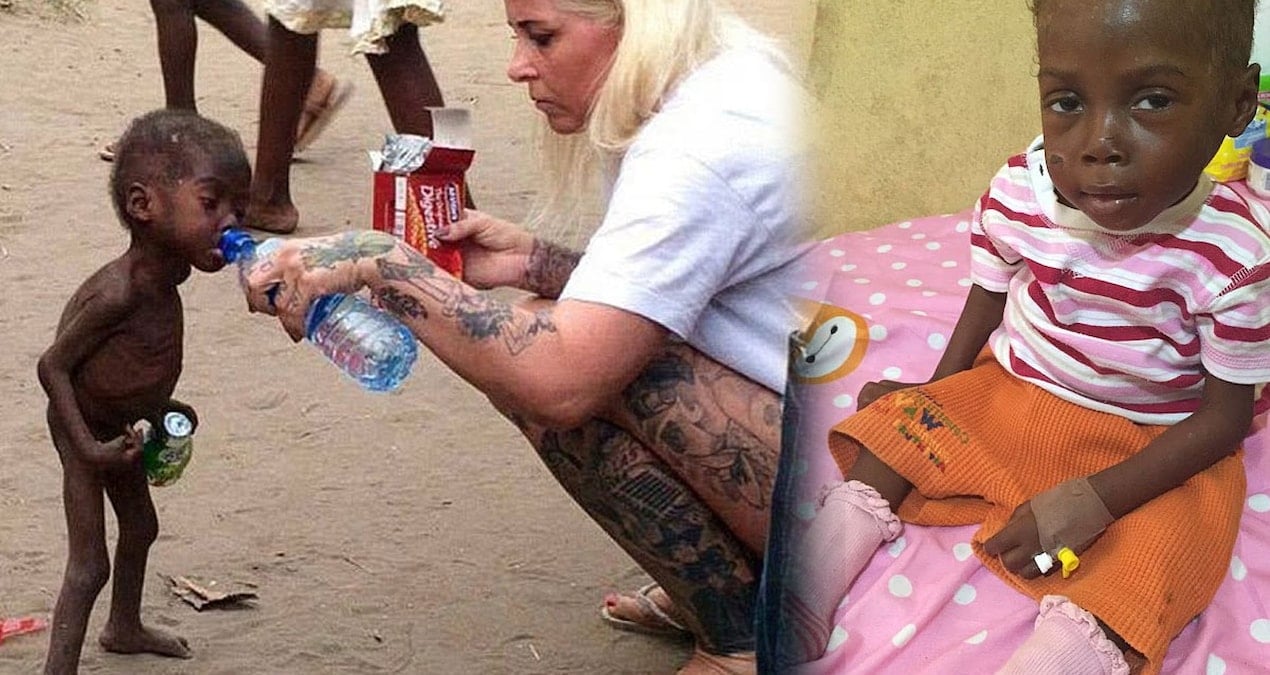 herkes onu 9 yil once bu fotografla tanimisti simdiki halini goren hayret ediyor zxqqtwHO